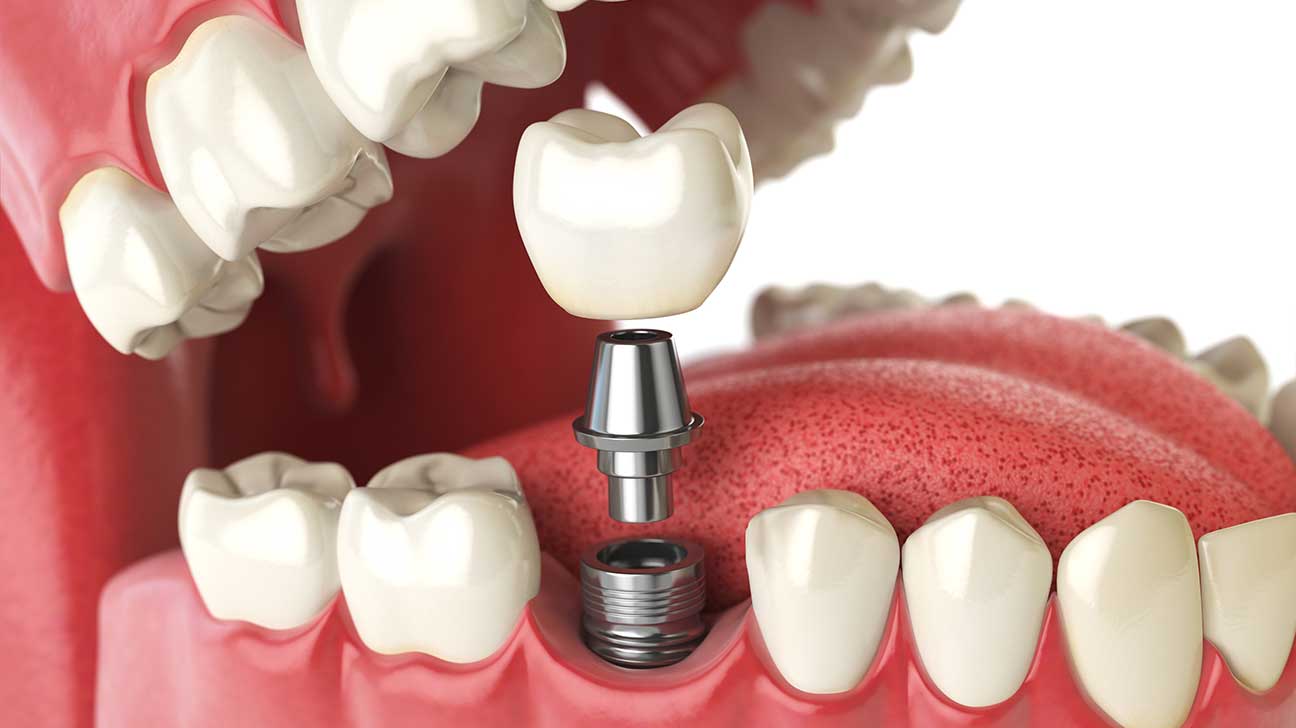 AL RAHMA DENTAL CLINIC TIRUR