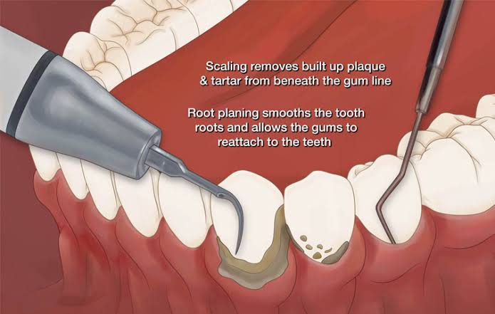 AL RAHMA DENTAL CLINIC TIRUR